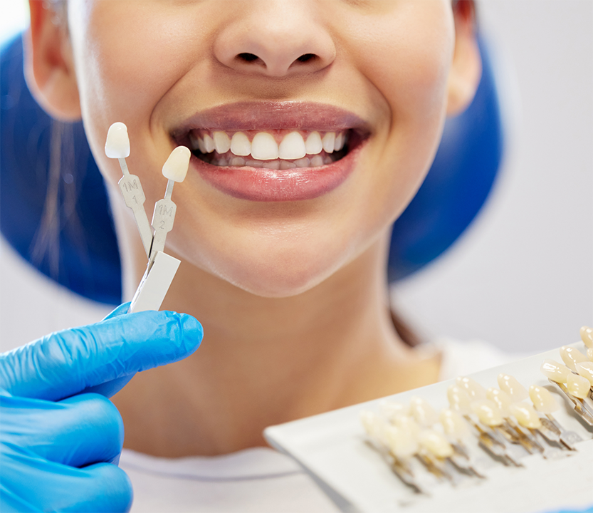 Holding veneers in front of a patient's smile