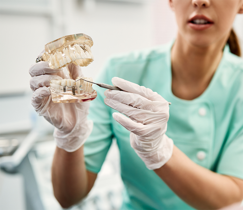 Holding a model of the mouth with dental implants
