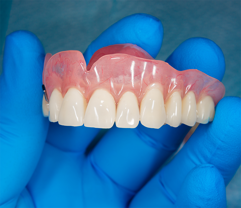 Holding a full upper denture in a gloved hand