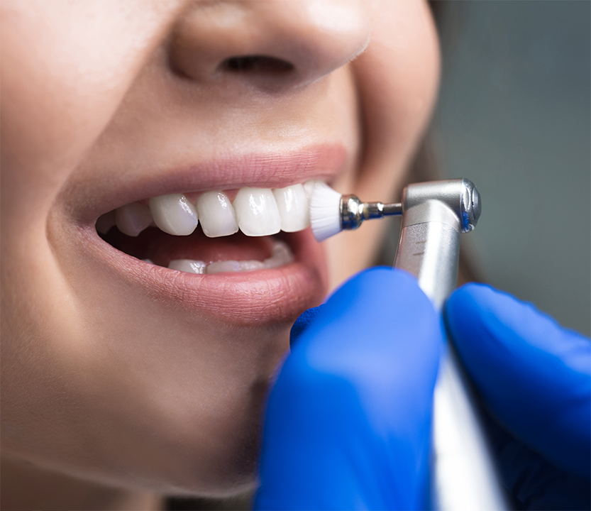 Close=up of a dental cleaning