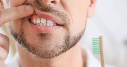 Man pointing to his gums