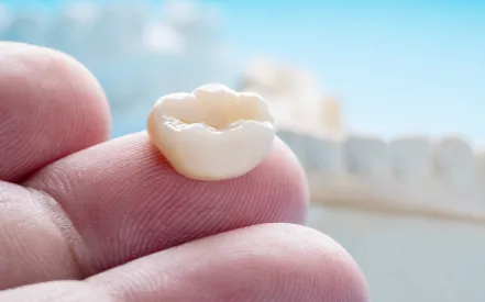 Dental crown on a person's finger